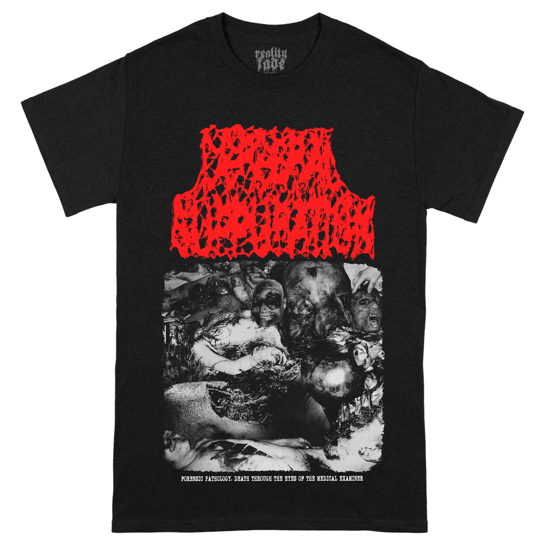 Cerebral Suppuration 'Forensic Pathology' T-Shirt