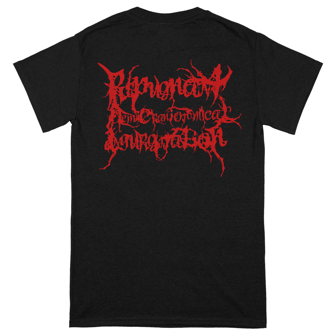 Epicardiectomy 'Repugnant Hemicraniotomical Ingurgitation' T-Shirt