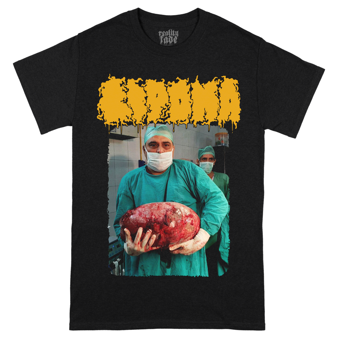 Lipoma '15KG Tumor' T-Shirt