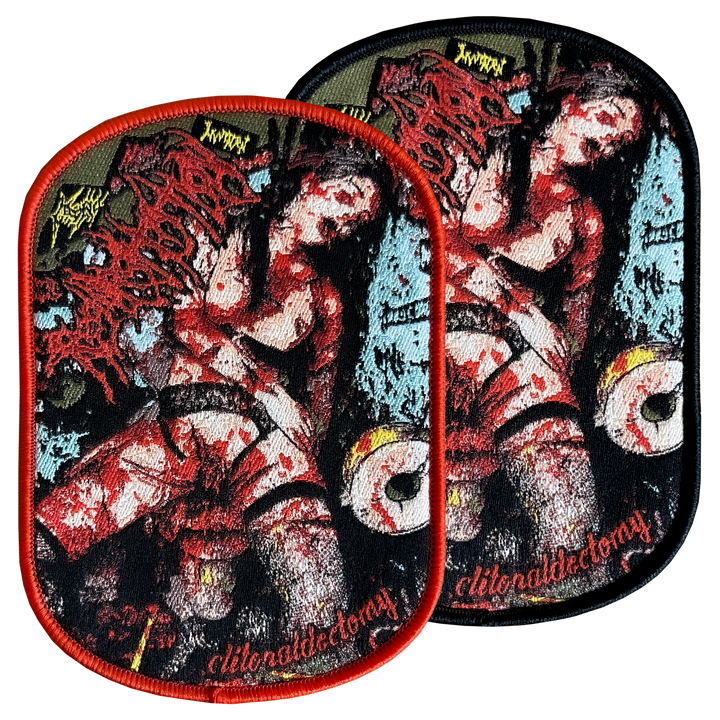 Regurgitation 'Clitoraldectomy' Patch