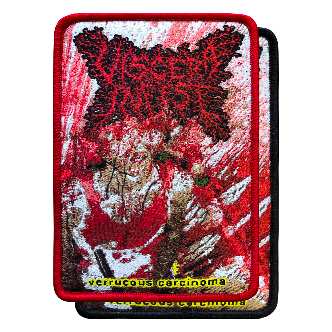 Viscera Infest 'Verrucous Carcinoma' Patch